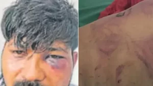 देहरादून में युवक से हैवानियत: गर्म रॉड से दागा, करंट के बाद गुप्तांग में पेचकस घोंपा